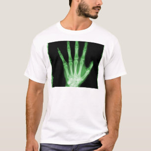 Camiseta Mano verde del esqueleto de la radiografía