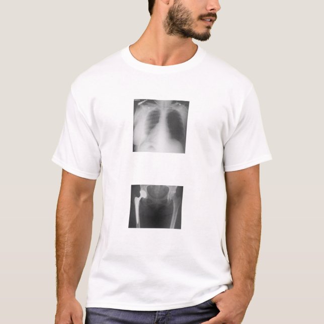 Camiseta Mi cadera apenas agrietada de tristeza (Anverso)