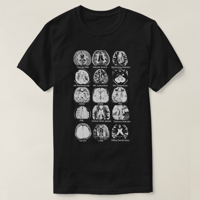 Camiseta Neurología Brain Dvhh Pml (Diseño del anverso)