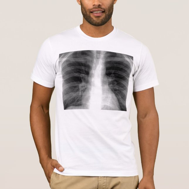 Camiseta Radiografía del pecho (Anverso)