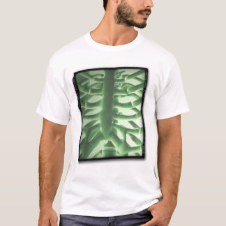 Camiseta Radiografía del pecho portátil de ACWE
