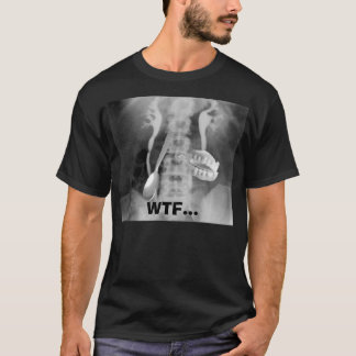 Camiseta radiografía, WTF…
