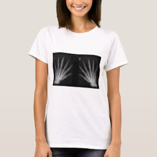 Camiseta Rayos X digitales extra a la derecha e izquierda