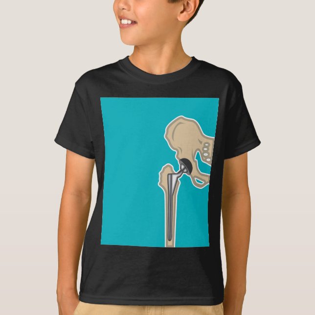 Camiseta Reemplazo de la junta de cadera (Anverso)