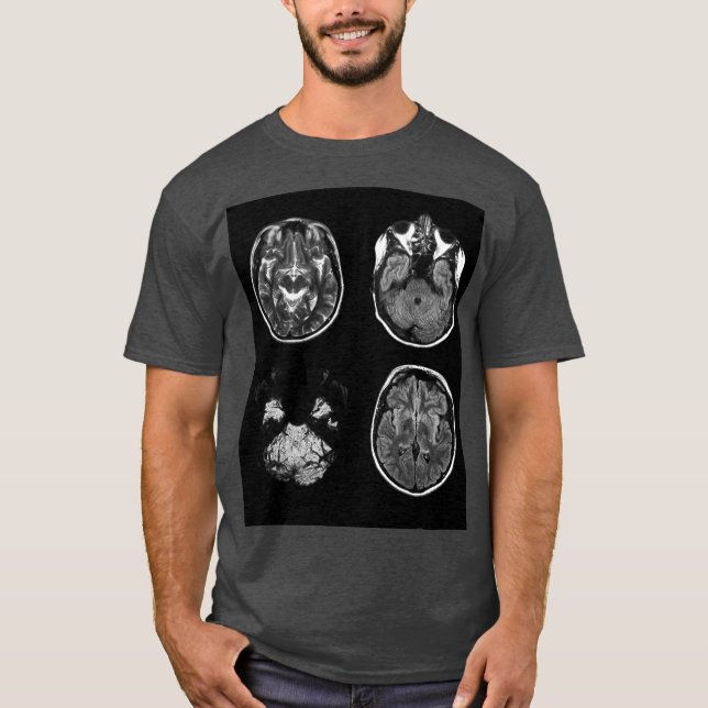 Camiseta Resonancia magnética cerebral (Anverso)