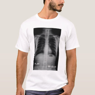 Camiseta “Retro VHS X-Ray” Radiografía de tórax al estilo a