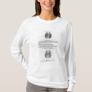 Camiseta Sistema vascular del cerebro