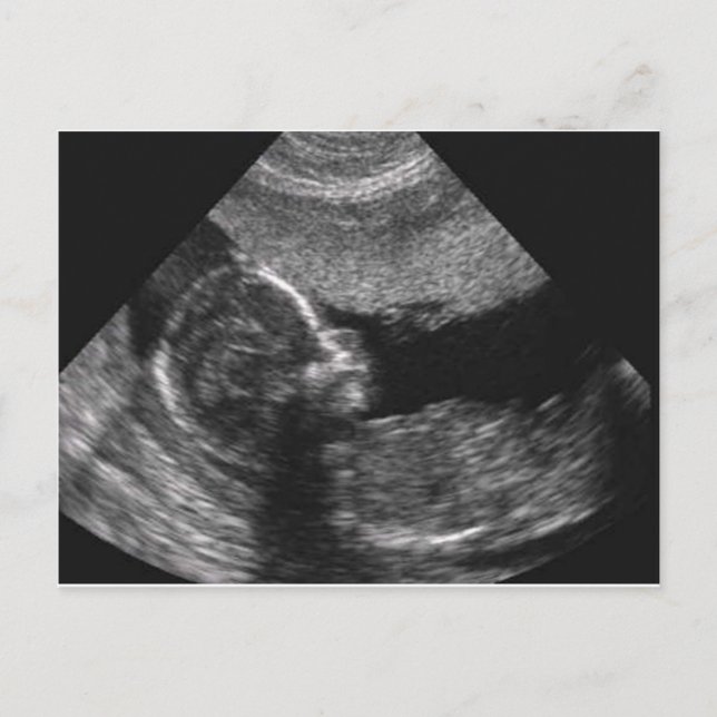 cara de bebé, tarjeta (Anverso)