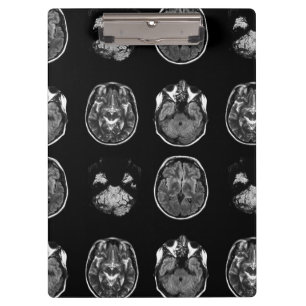 Carpeta De Pinza Resonancia magnética cerebral