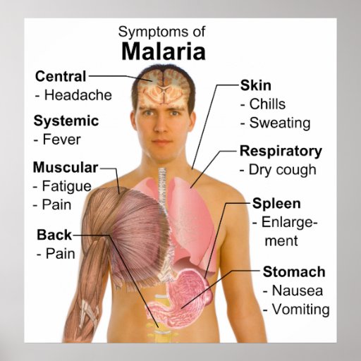 malaria symptoms,vaccine,treatment