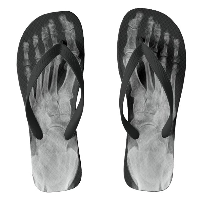 Chanclas Los pies esqueléticos de la anatomía del rayo X (Plantilla)
