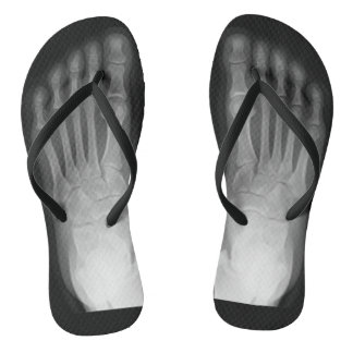 Chanclas ¡Pies de rayos X!