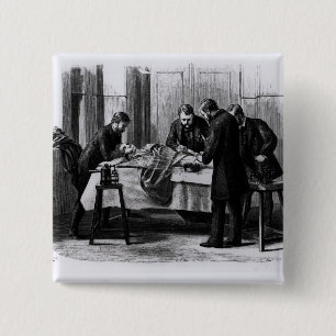 Chapa Cuadrada Cirugía antiséptica, 1882