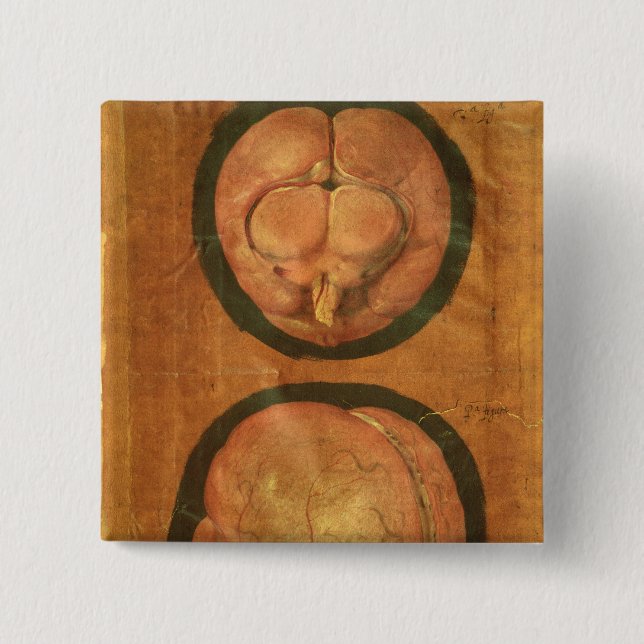 Chapa Cuadrada Dibujo anatómico del cerebro humano (Anverso)