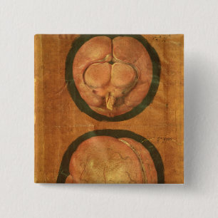 Chapa Cuadrada Dibujo anatómico del cerebro humano