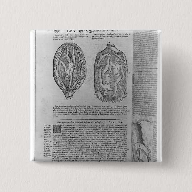 Chapa Cuadrada Feto, ilustracion de las 'obras (Anverso)