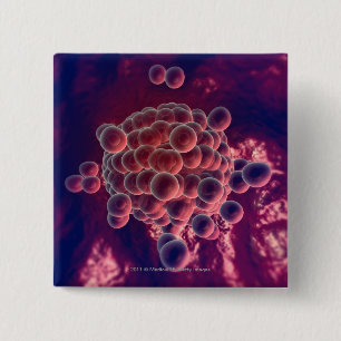 Chapa Cuadrada Huevos en un huevo