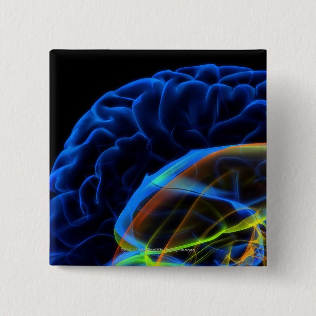 Chapa Cuadrada Imagen de la radiografía del cerebro (Anverso)