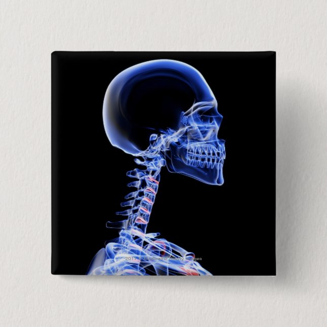 Chapa Cuadrada Radiografía de los huesos en el cuello (Anverso)