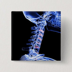 Chapa Cuadrada Radiografíe la imagen de los huesos del cuello