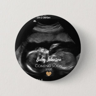 Chapa Redonda De 5 Cm Corazón de oro de ultrasonido Baby Coming Soon