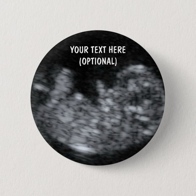 Chapa Redonda De 5 Cm Personalizado Baby Ultrasound Picture (Anverso)