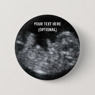 Chapa Redonda De 5 Cm Personalizado Baby Ultrasound Picture