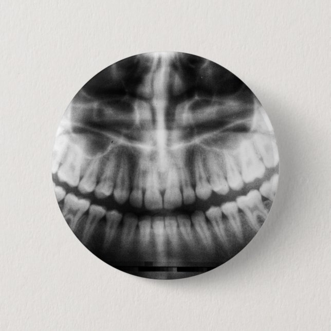 Chapa Redonda De 5 Cm Rayos X Dientes Boca Sonríe Negro y Blanco (Anverso)
