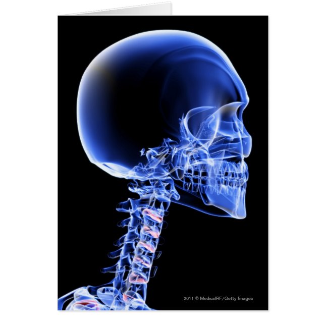 Ciérrese encima de la radiografía de los huesos en (Frente)