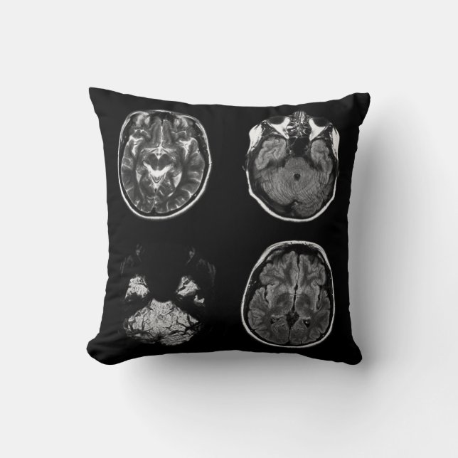 Cojín Decorativo Resonancia magnética cerebral (Anverso)