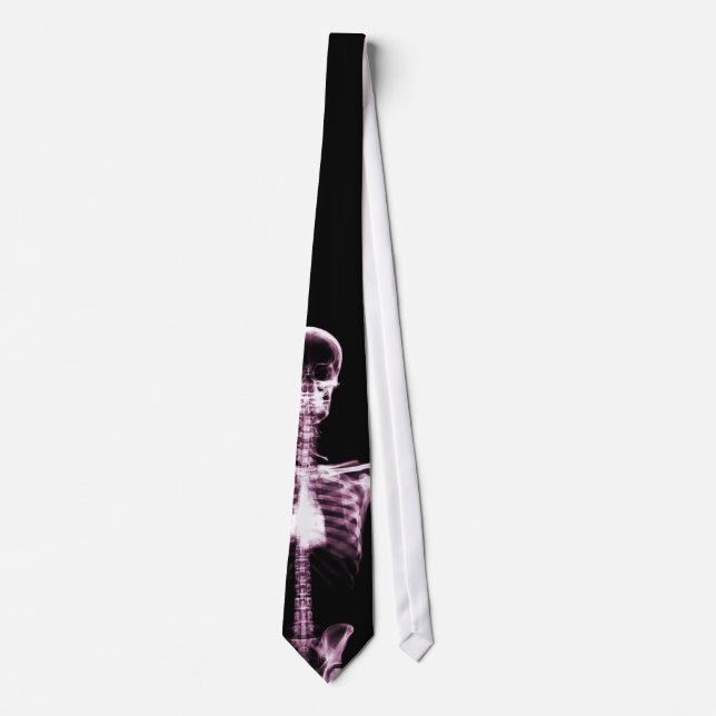 Corbata esquelética rosada de Vision de la (Anverso)