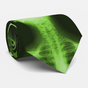 Corbata Rayado X 2 - Verde radiactivo