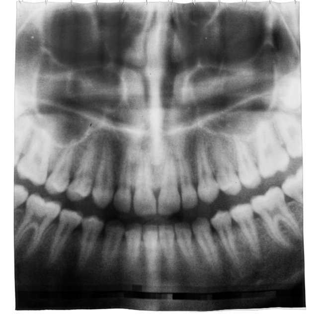 Cortina De Ducha Rayos X Dientes Boca Sonríe Negro y Blanco (Anverso)