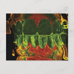 Crazy Teeth Model Diseño Tarjeta Ortodontista Dent