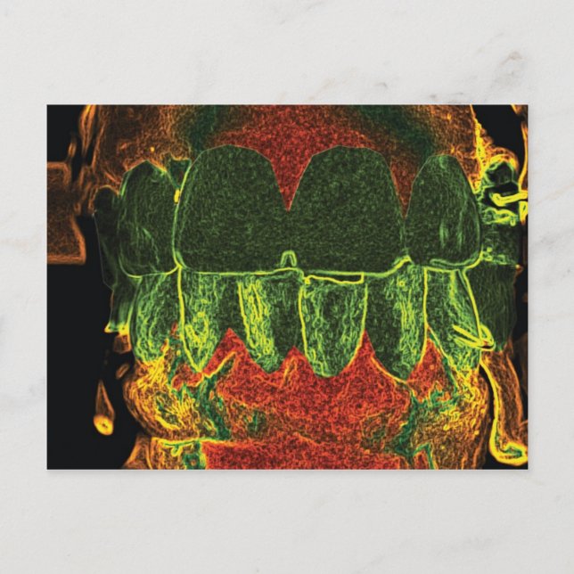 Crazy Teeth Model Diseño Tarjeta Ortodontista Dent (Anverso)