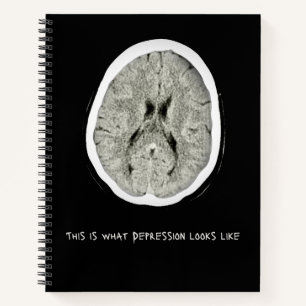 Cuaderno Así se ve la depresión.