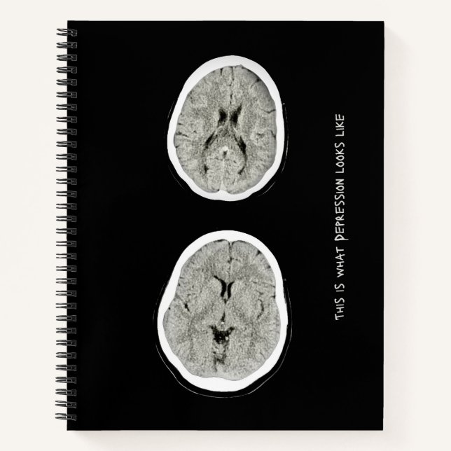 Cuaderno CT Scan_CTFOD_ Así es como se ve la depresión (Anverso)