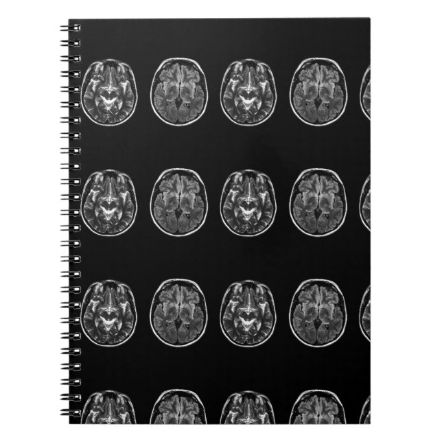 Cuaderno Exploración de mri cerebrales (Frente)