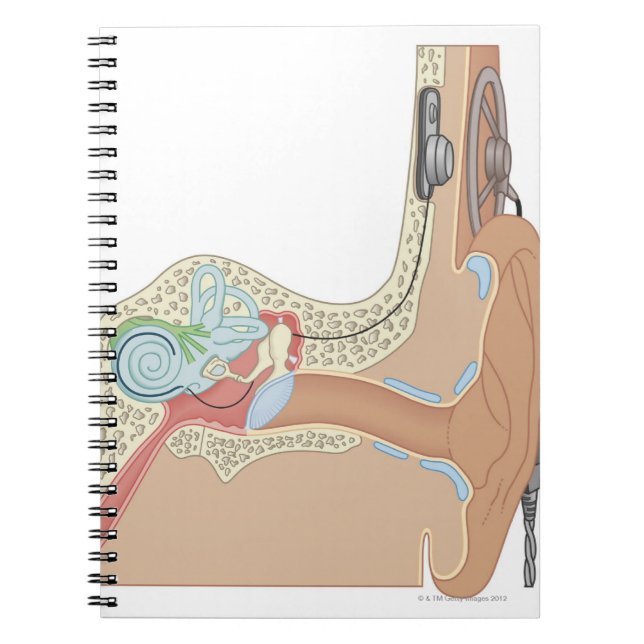 Cuaderno Implantes cocleares (Frente)