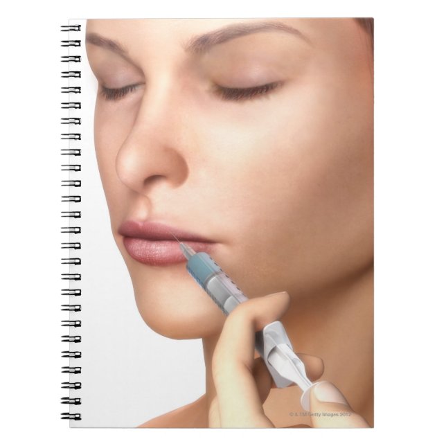Cuaderno Inyecciones de Botox (Frente)