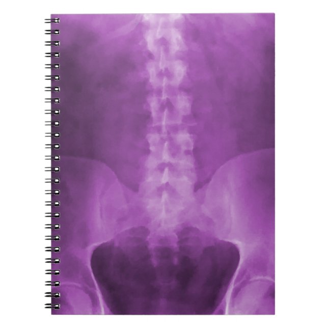 Cuaderno Portátil digital de rayos X morado (Frente)