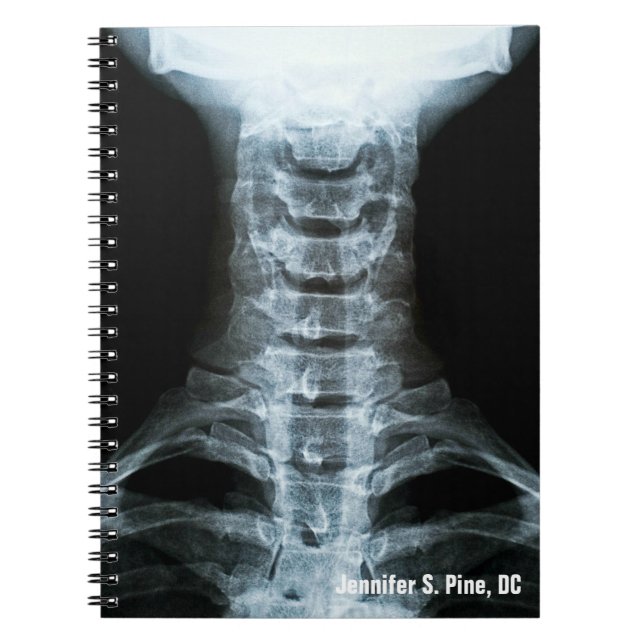 Cuaderno Portátil digital personalizado de rayos X (Frente)