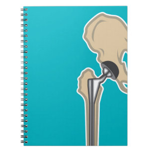 Cuaderno Reemplazo de la junta de cadera