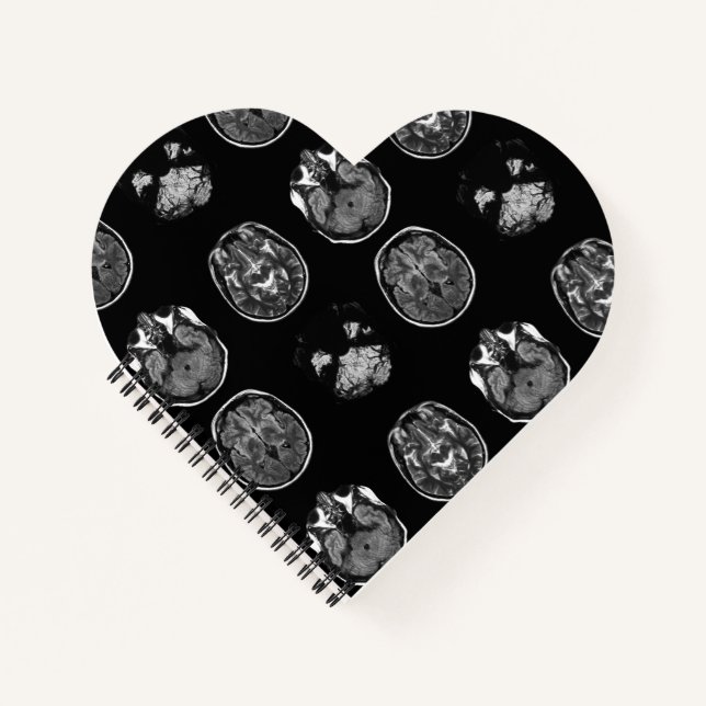 Cuaderno Resonancia magnética cerebral (Anverso)