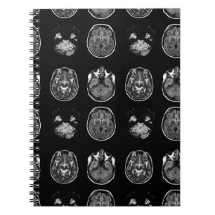 Cuaderno Resonancia magnética cerebral