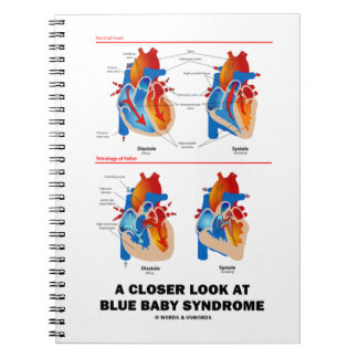Cuaderno Una mirada más cercana al síndrome del bebé azul a