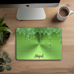 Cubierta Para iPad Pro Purpurina de perforación verde de lujo personaliza<br><div class="desc">Hermoso Purpurina De Perforación Verde Esparkle De Lujo Con Textura Metalizado Cinta Diseño Personalizado iPad Pro</div>