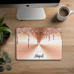 Cubierta Para iPad Pro Purpurina de Rosa de oro de espuma de lujo  person<br><div class="desc">Hermoso Purpurina de Rosa de lujo de chispa de oro con diseño de textura Metalizado cepillado iPad Pro personalizado</div>