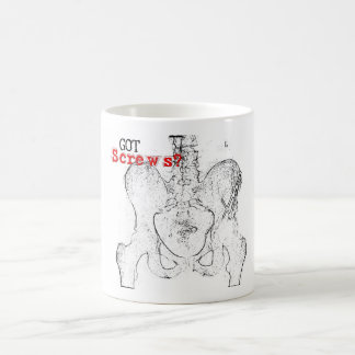 De Café ¿Tornillos conseguidos? Taza
