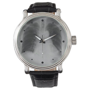 De Pulsera Reloj del ~ del rayo del pecho X